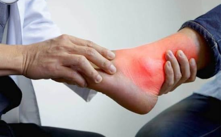 ANKLE SPRAIN TREATMENT & TAPING
